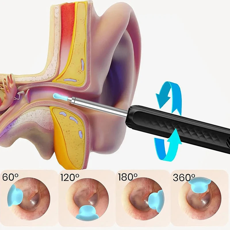 Ear Wax removal kit with Camera