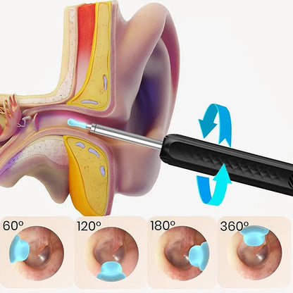 Ear Wax removal kit with Camera